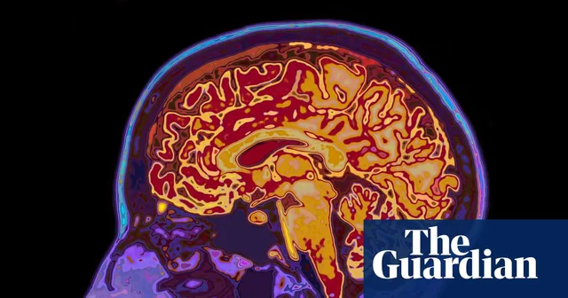 fMRI显示多睡1小时孩子大脑注意力提升